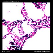 microscopy of clostridium perfringens